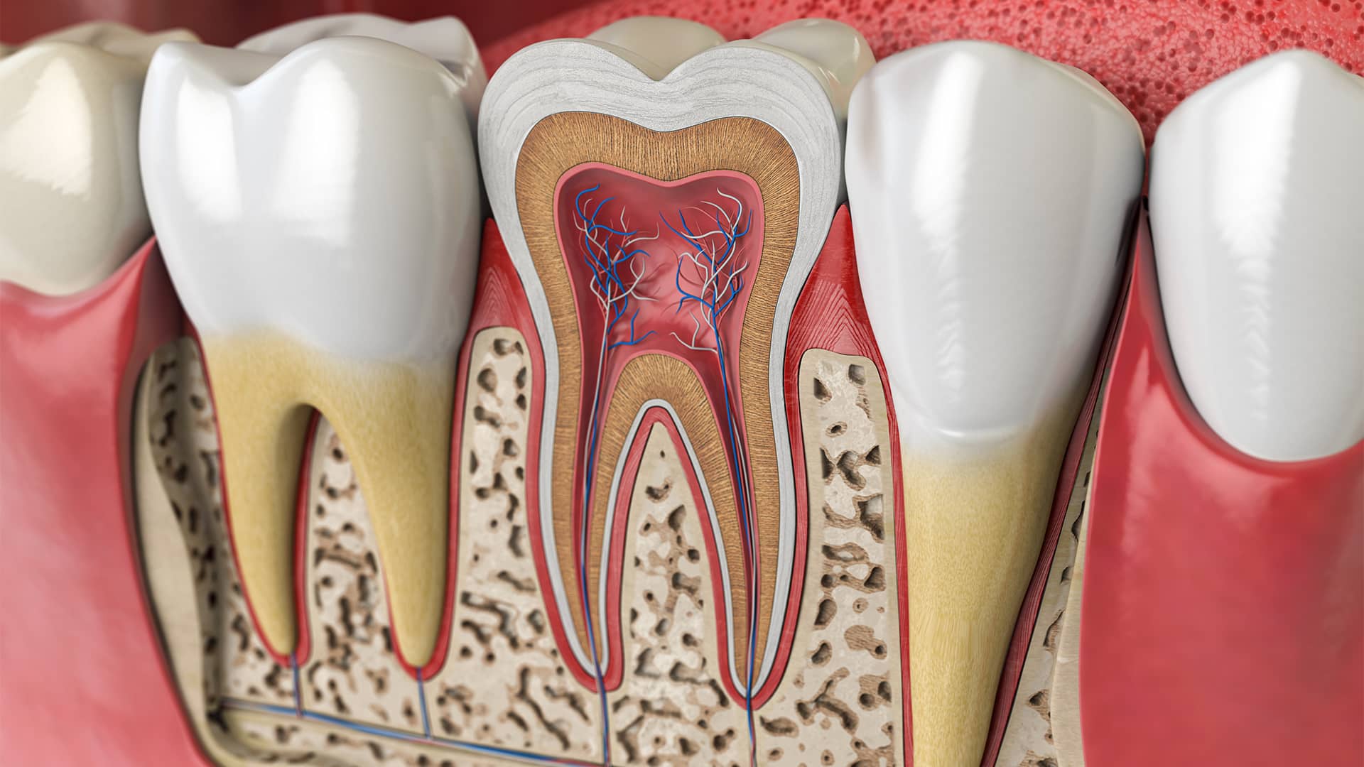 root-canal